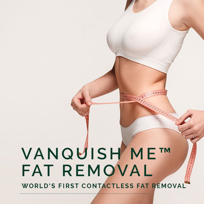 vanquish fat removal