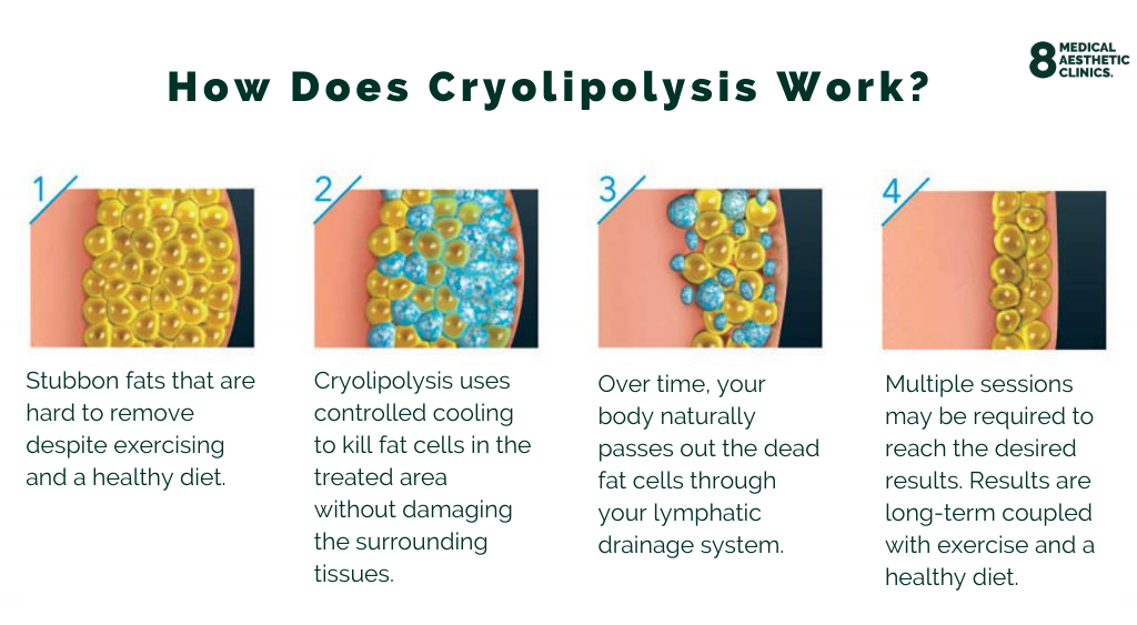 How does cryolipolysis work?